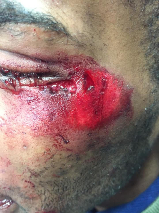 Illustration for article titled Bronx, NY, Man Allegedly Beaten by Pizzeria Employee With Wooden Pizza-Making Tool Demands Justice